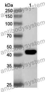 Anti-Human GNAT1 Polyclonal Antibody