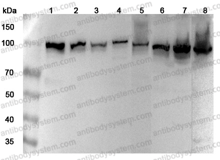 Anti-Human MTHFD1 Polyclonal Antibody