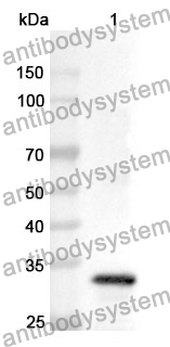 Anti-CETP Polyclonal Antibody