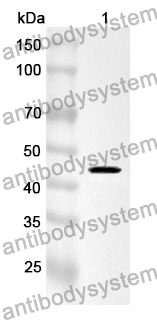 Anti-SFTPC Polyclonal Antibody