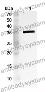 Anti-CDK4 Polyclonal Antibody