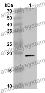 Anti-CD20/MS4A1 Polyclonal Antibody