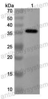 Anti-Human PRPS2 Polyclonal Antibody