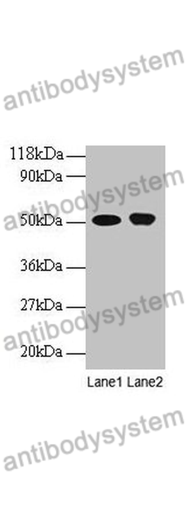 Anti-ODC1 Polyclonal Antibody