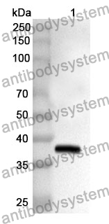 Anti-Human NEFH Polyclonal Antibody