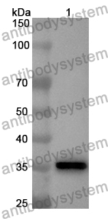 Anti-HARS1 Polyclonal Antibody