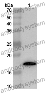 Anti-FABP2 Polyclonal Antibody