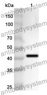 Anti-COL6A2 Polyclonal Antibody