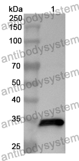 Anti-IMPDH2 Polyclonal Antibody