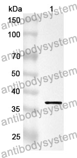 Anti-RLBP1 Polyclonal Antibody