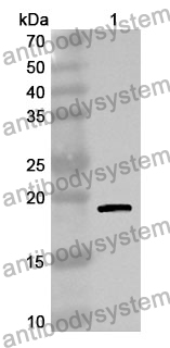 Anti-PIP Polyclonal Antibody