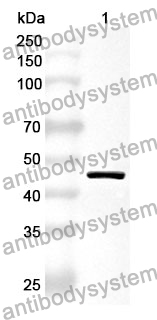 Anti-CKB Polyclonal Antibody