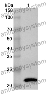 Anti-Human FCER1A Polyclonal Antibody