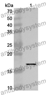 Anti-ANXA3 Polyclonal Antibody