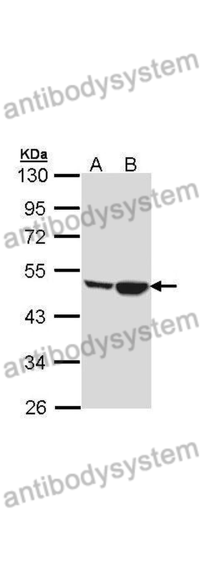 Anti-CKMT1A Polyclonal Antibody