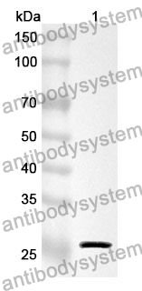 Anti-CKMT1A Polyclonal Antibody