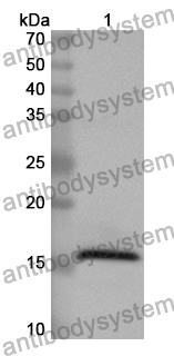 Anti-Human SKIL Polyclonal Antibody