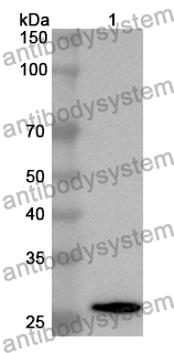 Anti-Human ACTN1 Polyclonal Antibody