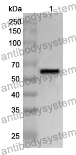 Anti-CD143/ACE Polyclonal Antibody