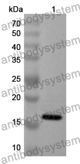 Anti-MYH1 Polyclonal Antibody