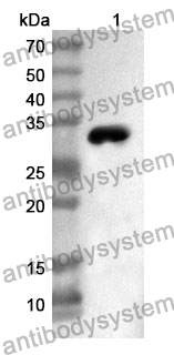 Anti-MYH7 Polyclonal Antibody