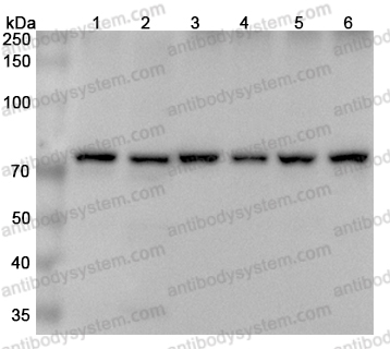 Anti-Human XRCC6 Polyclonal Antibody