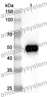 Anti-Human ALAS1 Polyclonal Antibody