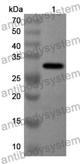 Anti-IFI30 Polyclonal Antibody