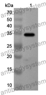 Anti-CCL5 Polyclonal Antibody