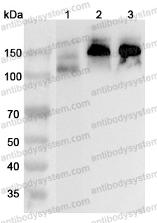 Anti-CD56/NCAM1 Polyclonal Antibody