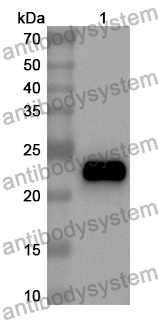 Anti-CD56/NCAM1 Polyclonal Antibody