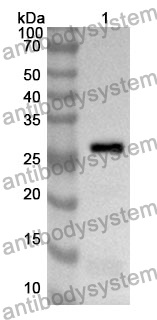 Anti-CD102/ICAM2 Polyclonal Antibody