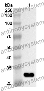 Anti-Human RARG Polyclonal Antibody