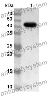 Anti-EEF2 Polyclonal Antibody