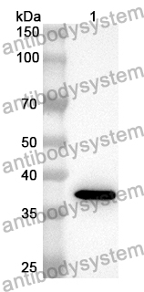 Anti-KRT10 Polyclonal Antibody