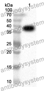 Anti-KRT5 Polyclonal Antibody