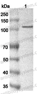 Anti-C6 Polyclonal Antibody