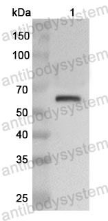 Anti-Human P4HA1 Polyclonal Antibody