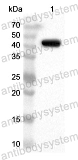 Anti-Human P4HA1 Polyclonal Antibody