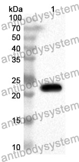 Anti-OSM Polyclonal Antibody