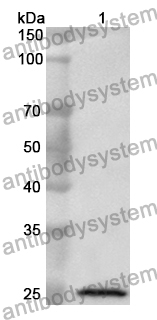 Anti-Human C1q Complement Polyclonal Antibody, FITC