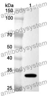 Anti-LCP1 Polyclonal Antibody