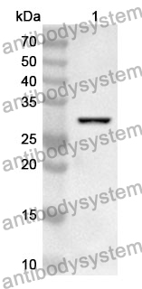 Anti-PLS3 Polyclonal Antibody