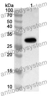 Anti-ETFA Polyclonal Antibody