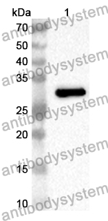 Anti-Human GYS1 Polyclonal Antibody