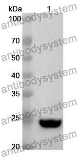 Anti-Human CD59 Polyclonal Antibody