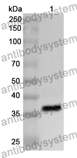 Anti-Human MTHFD2 Polyclonal Antibody