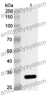 Anti-Human HSD17B1 Polyclonal Antibody