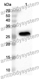 Anti-Human FOLR2 Polyclonal Antibody