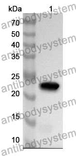 Anti-HGF Polyclonal Antibody